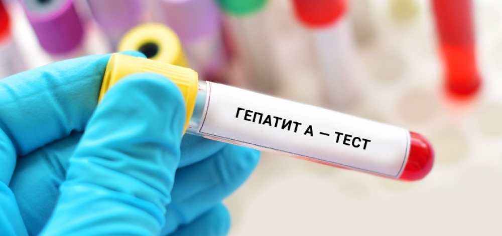 Вирусный гепатит А. Что надо знать, чтобы не заболеть?